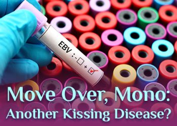 Lexington dentist, Dr. Brewer at Brewer Family Dental, talks about a kissing disease you might be less familiar with than mononucleosis.