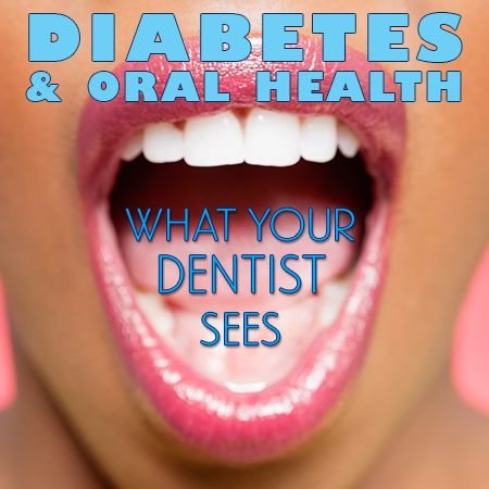 diabetes linked to oral care Lexington KY