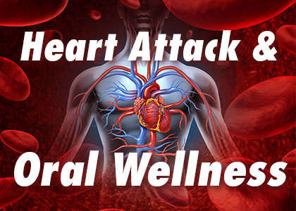 Lexington dentist, Dr. Kevin Brewer at Brewer Family Dental explains the connection between poor oral hygiene and heart attacks.