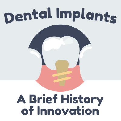 Lexington dentist, Dr. Kevin Brewer of Brewer Family Dental discusses dental implants and shares some information about their history.