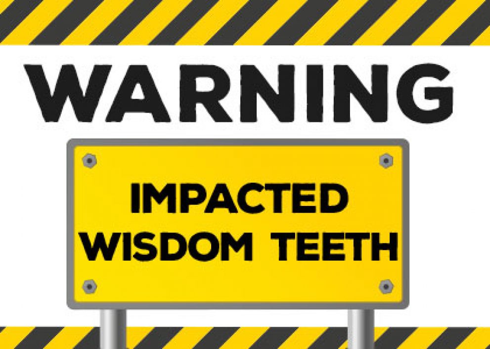 dental-info-warning-signs-of-impacted-wisdom-teeth