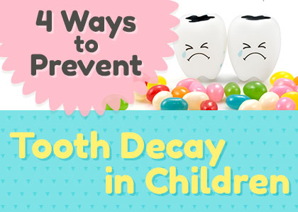 Lexington dentist, Dr. Kevin Brewer at Brewer Family Dental shares four easy ways to help prevent tooth decay in children so they can have a head start on a healthy, happy smile for life.