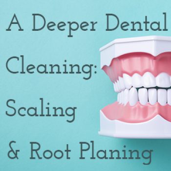 Lexington dentist, Dr. Kevin Brewer at Brewer Family Dental tells patients about what scaling and root planing is and why it might be part of your treatment plan.