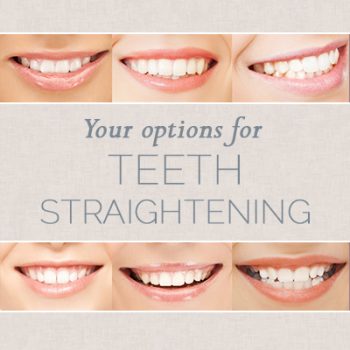 Lexington dentist, Dr. Kevin Brewer at Brewer Family Dental shares all you need to know about choosing the right teeth straightening option for you.