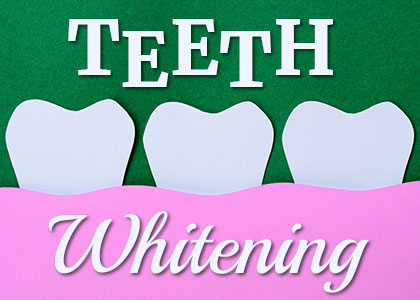 Lexington dentist, Dr. Kevin Brewer at Brewer Family Dental shares everything you need to know about different types of teeth whitening.
