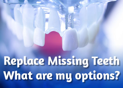 Lexington dentist, Dr. Kevin Brewer of Brewer Family Dental discusses the tooth replacement options available to replace missing teeth and restore your smile.