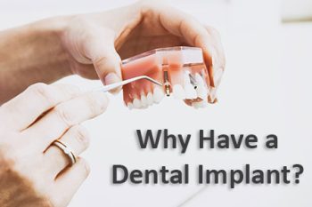 Lexington dentist, Dr. Brewer at Brewer Family Dental, discusses dental implants and why they might be a good choice for you.