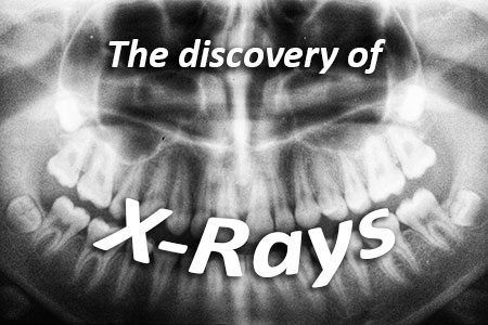 The discovery of x-rays explained by Brewer Family Dental in Lexington, KY